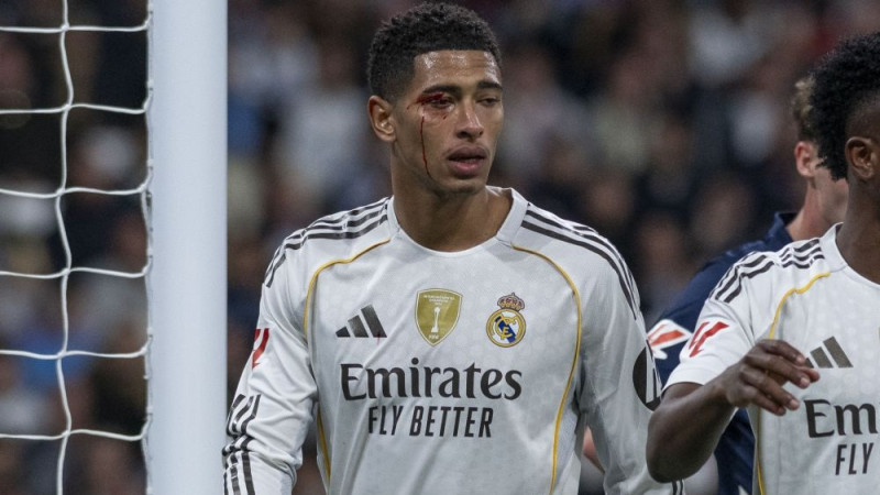 Eiropas lielklubu sadursme Madridē – traumu nomāktā ″Real″ uzņem ″City″